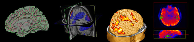 Neuroimaging Group
